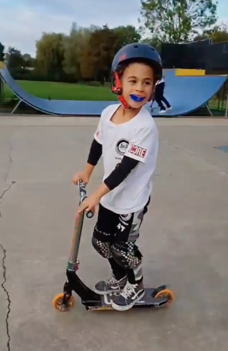 mouthguard for pro scooter riding